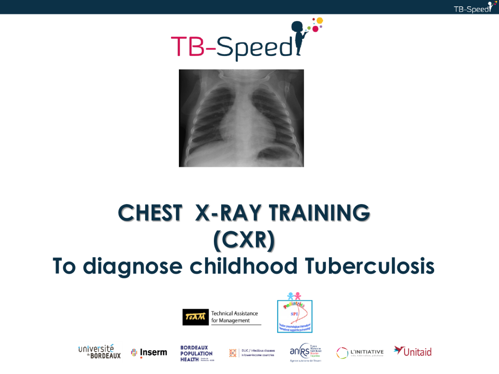 Interpret Child CXR